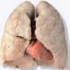 The Worlds Best Lung Detox Program Picture